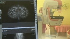 Na mamograf se ženy měly dostat i bez žádanky. Centra ji však stále vyžadují