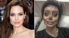 Měla vypadat jako Angelina Jolie. Takhle po 50 operacích dopadla!