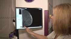 Na preventivní vyšetření rakoviny prsu ženy čekají měsíce. Doba záleží na kraji