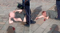 Polonahý agresor útočil na strážnici, skončil se zkrvavenou hlavou!