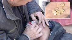 Pláč ženě působí muka: Místo slz brečí kameny! FOTO PRO OTRLÉ
