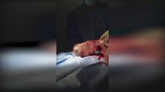 Nádherné zrození: Dítě se narodilo ještě v plodovém vaku! VIDEO