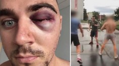 Surový útok na videu! Adama zbili čtyři muži, čeká ho už třetí operace