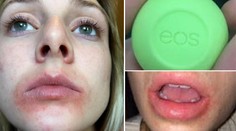 Použila oblíbený balzám na rty a takhle dopadla! EOS čelí žalobě