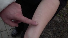 Nože nebo nůžky. Desítky tisíc dětí se sebepoškozují, jejich počet strmě roste