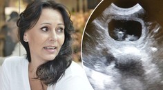 Heidi čeká přírůstek do rodiny! Pochlubila se fotkou z ultrazvuku