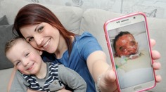 Jsou to neštovice, tvrdili doktoři. Z chlapce odpadávaly kusy kůže!