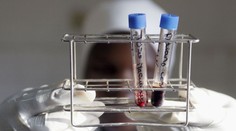 Studie velmi znepokojila vědce. V lidské krvi našli mikroplasty