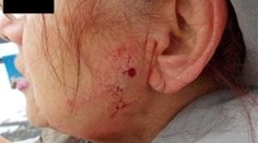 Kluci (12 a 17) stříleli vzduchovkou po seniorce, trefili ji do tváře