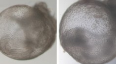 Přelom ve vědě. Výzkumníci vypěstovali první umělé embryo bez spermie i vajíčka