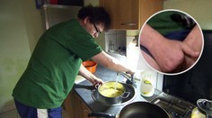 Drsná nehoda ve Výměně: Pavel přišel o prsty, rodinu živí manželka