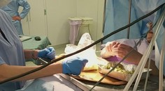 60letá žena z Itálie během skoro tříhodinové operace mozku plnila olivy