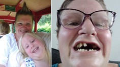 Britka si sama vytrhla 11 zubů. "Neměla jsem na zubaře a teď trpím," pláče