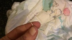 Šokující nález! Maminka našla v plence dvouletého syna jehlu