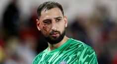 Deset stehů a nucená pauza. Hvězda PSG kurýruje děsivé zranění ze šlágru
