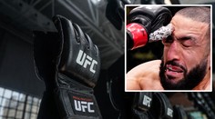 Ošklivé zranění vyvolalo debatu: UFC zápasníci chtějí bezpečnější rukavice!