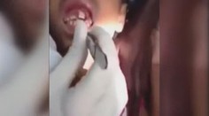 Horor: Zubař málem omdlel! Tuhle hrůzu Aničce vyndal z úst! VIDEO