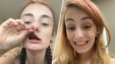 Žena přišla ve 22 letech o všechny zuby. Příčina překvapila i lékaře