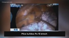 TO JE ROZDÍL: Plíce kuřáka a zdravého člověka! VIDEO