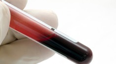 Neobjevená nemoc může zabít 80 milionů lidí, varují experti