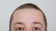 Utekl nebezpečný schizofrenik! Chodí s nožem v ruce