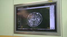 Prahou jezdí fialově zdobená tramvaj. Připomíná podporu pacientů v boji proti epilepsii