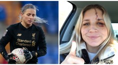Připomíná Harryho Pottera! Brankářce Liverpoolu spoluhráčka rozsekla čelo&nbsp;