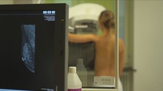 Mladí lidé si některá preventivní vyšetření platí sami. Přesto na ně čekají měsíce