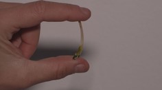 Kost ženu málem připravila o život. Lékaři nevěřili vlastním očím