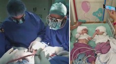V Izraeli provedli unikátní separační operaci siamských dvojčat