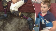 Lékař popletl diagnózu, chlapec (3) přišel o obě nohy!