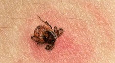 Sezóna klíšťat je tu! Příručka radí, jak na ně. Stáhněte si ji!