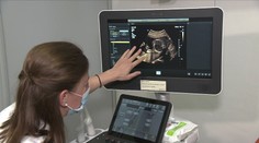 Nemoci ledvin trápí milion Čechů. Někteří by na kontrolu měli chodit každý rok