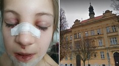 Pád dívky (8) ve škole vyšetřuje policie! Podle matky mohla zemřít