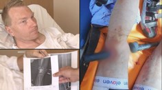 VELKÝ ROZHOVOR s cyklistou, který si propíchl nohu řidítky! Co řekl o nehodě?