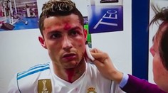 Ronaldovo krvavé zranění zblízka: Tohle dělal lékař v kabině! VIDEO