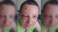 Napomenul dítě na dětském hřišti. Takhle ho zřídili jeho rodiče