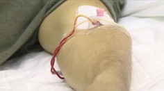 V Česku se rychle šíří žloutenka typu A. Hygienici radí, kde si na ni dávat pozor