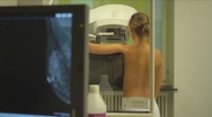 Rakovinu prsu, kterou našli Slováčkové, je důležité léčit včas. Tak se dá porazit