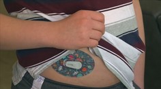 Svět si připomíná den diabetu. Čechů s cukrovkou je čím dál více