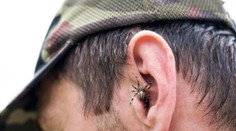 V ženině uchu žil pavouk. Nejde o ojedinělý případ, varují lékaři