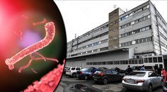 V Rusku explodovala laboratoř s viry HIV, eboly či pravých neštovic!