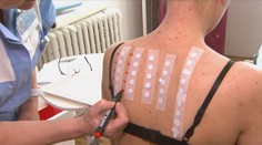 Alergiků stále přibývá. Experti prozradili příčiny i možnosti léčby