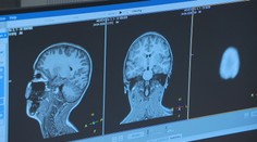 Magnetická rezonance bez strachu. Hra pomáhá dětem zvládnout vyšetření