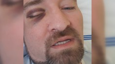 Fotbalista vážně zranil svého protihráče! Už padly první tresty