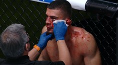 Jen pro otrlé! UFC fighter málem přišel o ucho, rozhodčí musel zápas zastavit