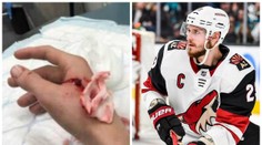 Stehy a tetanus! Hvězdného obránce NHL pokousal jeho vlastní pes