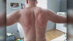 Je to, jako by zmutovali, popisuje muž řádění komárů v Chorvatsku