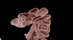 HYGIENIK RADÍ: Jak se bránit nebezpečné bakterii E.coli