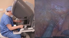 Lékaři operují častěji pomocí robotů. Důvodem je přesnost zákroků